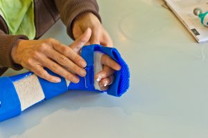 Hand Therapy in Berkeley Heights, NJ