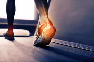 Ankle Physical Therapy NJ